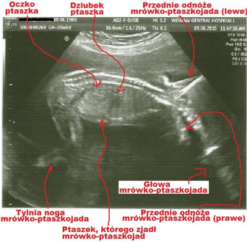 bd832df063958db5med.jpg